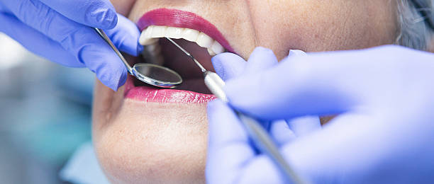 Best Chipped Tooth Repair Near Me  in Oli, PA