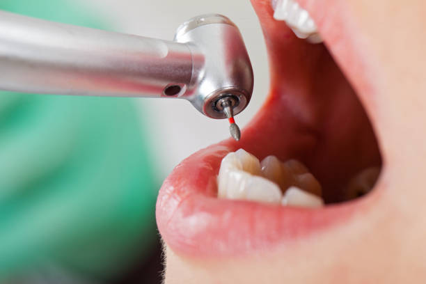 Best Tooth Infection Emergency Dentist  in Oli, PA
